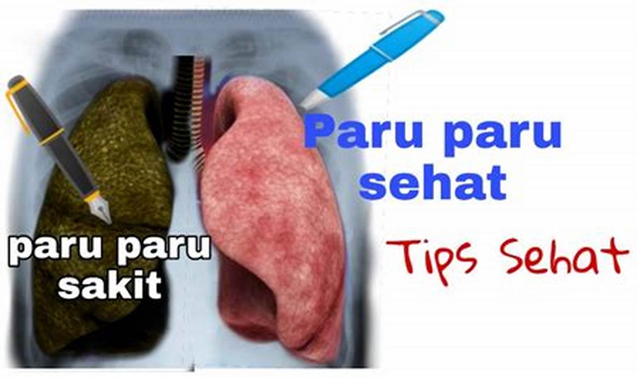 Cara Mengatasi Paru Paru Basah: Panduan Lengkap